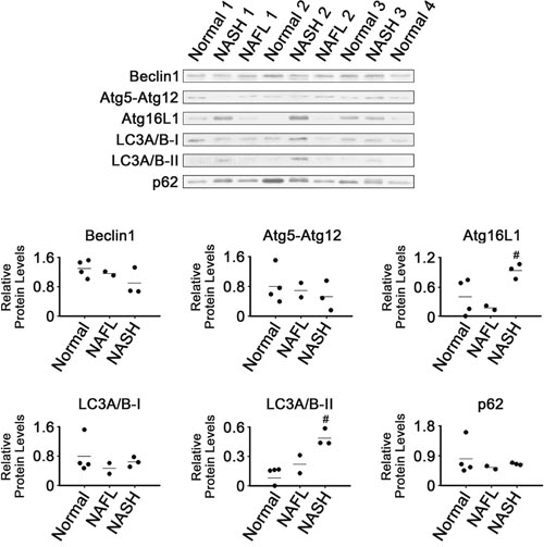 Expression of proteins related to autophagy in NASH, NAFL and normal liver tissues.