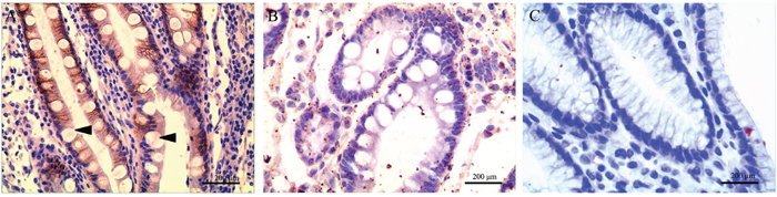 CD24 expression in gastric intestinal metaplasia (GIM).