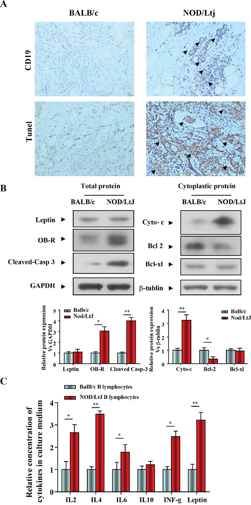 B lymphocytic infiltration and apoptosis in salivary gland tissue in mice with SjS.
