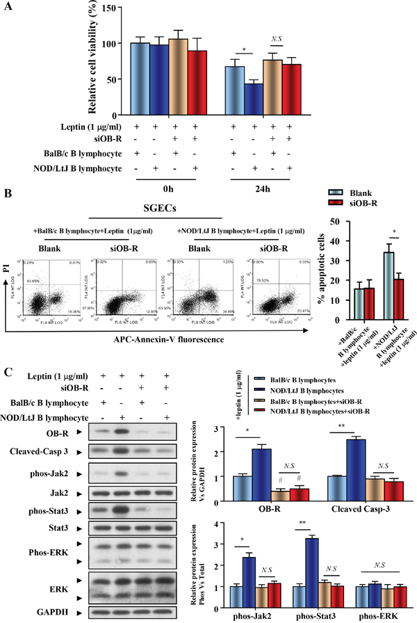 OB-R promotes B lymphocyte-induced apoptosis of SGECs in SjS.