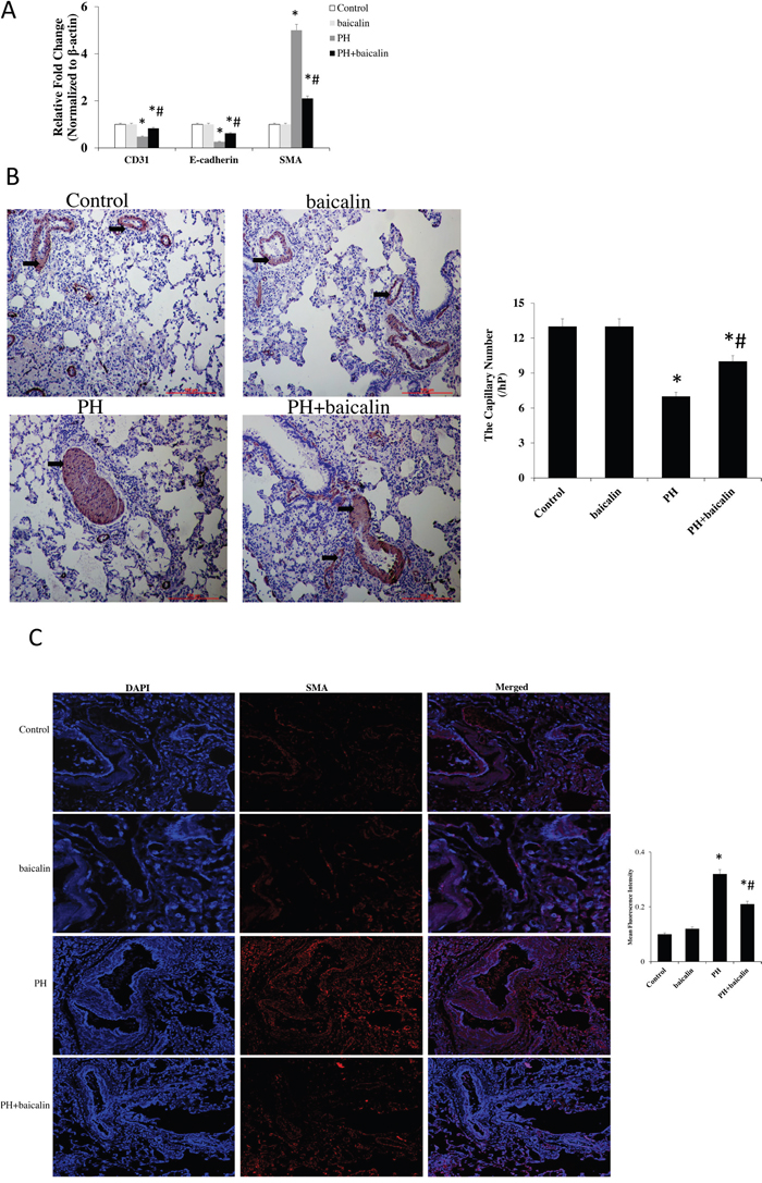 Effected of baicalin on MCT-induced endothelial-to-mesenchymal transition in lung.