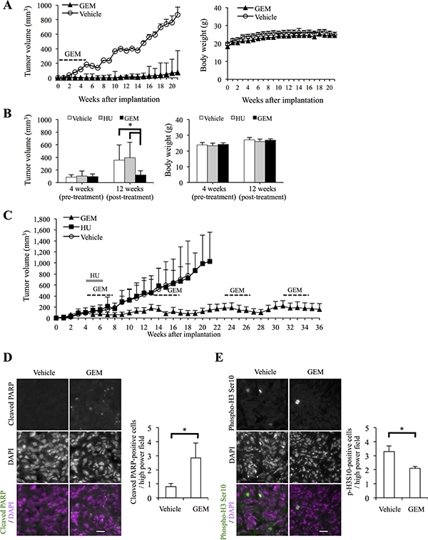 Systemic gemcitabine administration inhibits tumor initiation and progression of high-grade meningioma and provides long-term control.