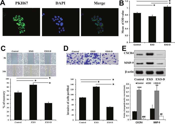 Panc02-H7-derived exosomes promote metastatis-related characteristics in vitro.
