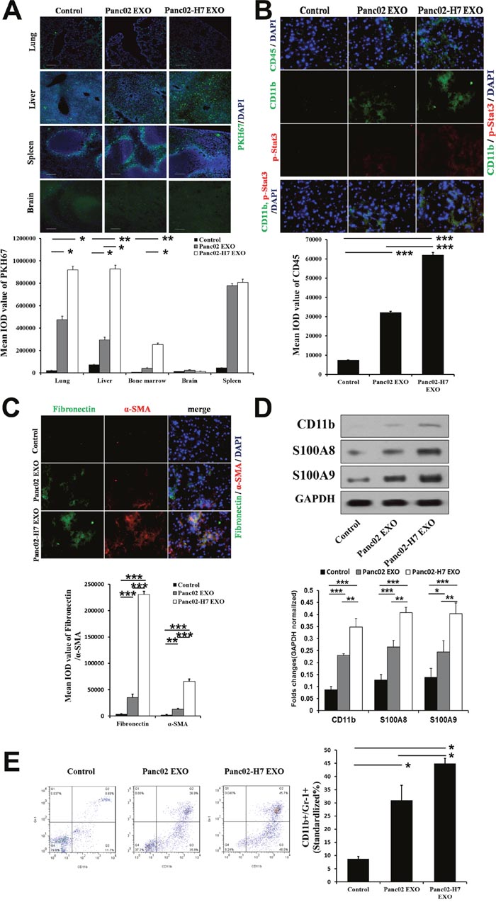 Pancreatic cancer-derived exosomes mediate liver pre-metastatic niche formation.
