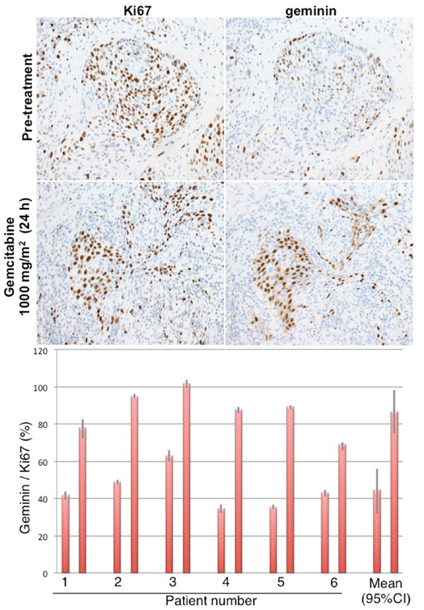Cell cycle perturbation induced in bladder tumors of patients administered gemcitabine.