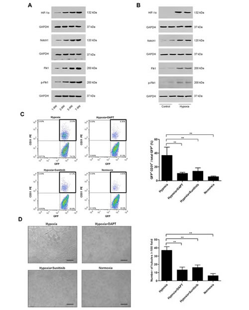 Role of HIF-1&#x3b1;, Notch1 and Flk1 in C6 glioma cells transdifferentiation.