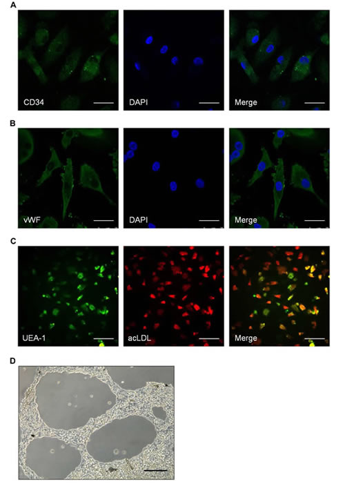 Identifying the characteristics of spleen-derived endothelial progenitor cells (EPCs).