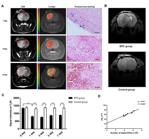 Magnetic resonance imaging (MRI) tracking and quantifying of EPCs incorporation into tumor