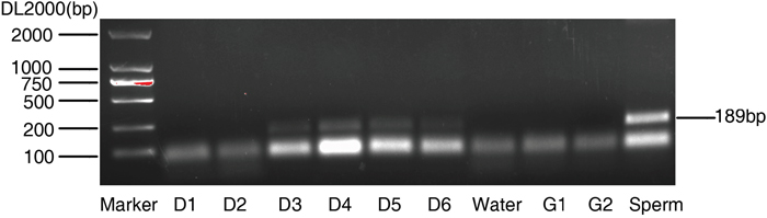 Amplification of Y-chromosomal sequences from blastocyst culture medium.