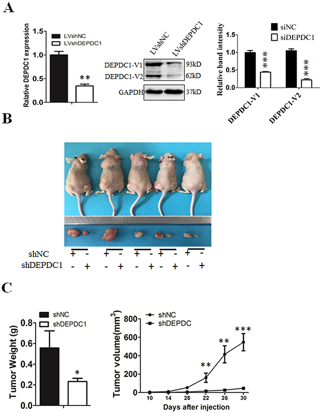 DEPDC1 depletion inhibits tumor growth in vivo.