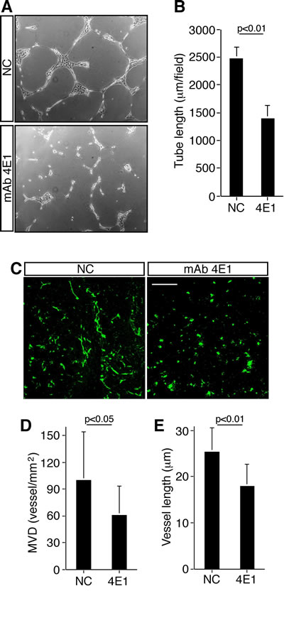 Fugure 2: The mAb 4E1 impairs angiogenesis in vivo.