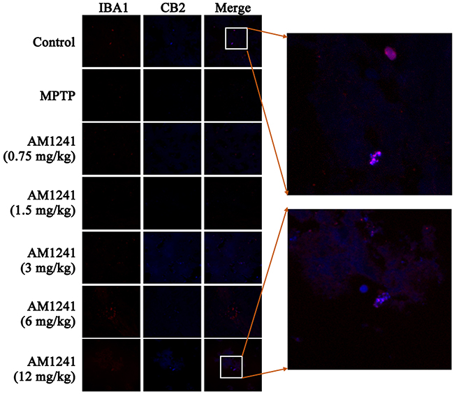 Immunostaining for neurogenesis in cortex and brainstem of MPTP-induced PD mice.