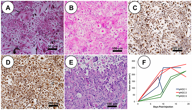 pHCC recapitulates cytologic and histologic features of human HCC both in vitro and in vivo.