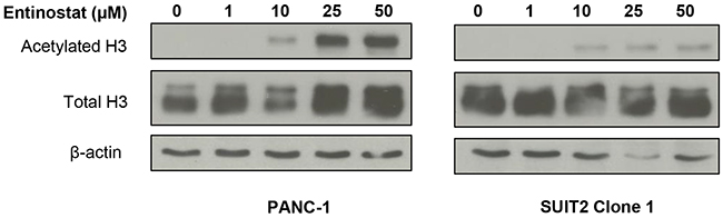 Effects of entinostat on histone H3 acetylation.