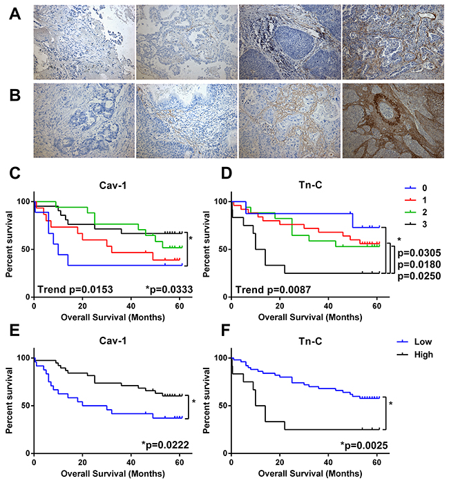 Predictive value CAF markers in NSCLC.