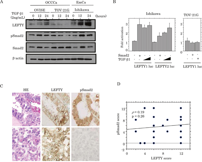 Relationship between LEFTY expression and TGF-&#x03B2;1/Smad signaling.