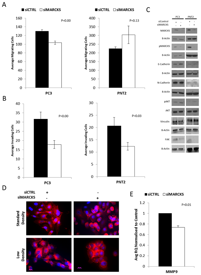 MARCKS promotes invasion and is associated with altered actin patterning.