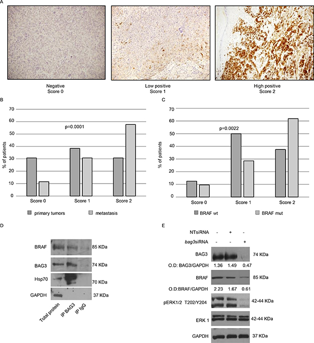 Analysis of BAG3 expression in human melanoma&#x0027;s metastases and its functional correlation with BRAFV600E.