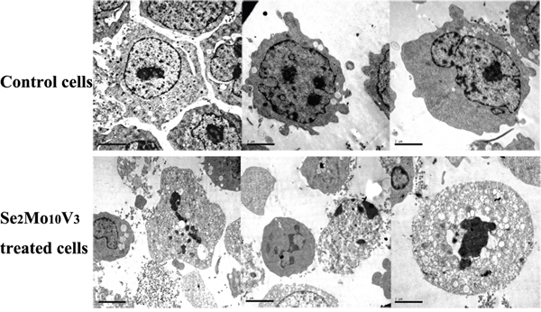 50 mg/L Se2Mo10V3 induced apoptosis in K562 cells in a TEM expreiment.