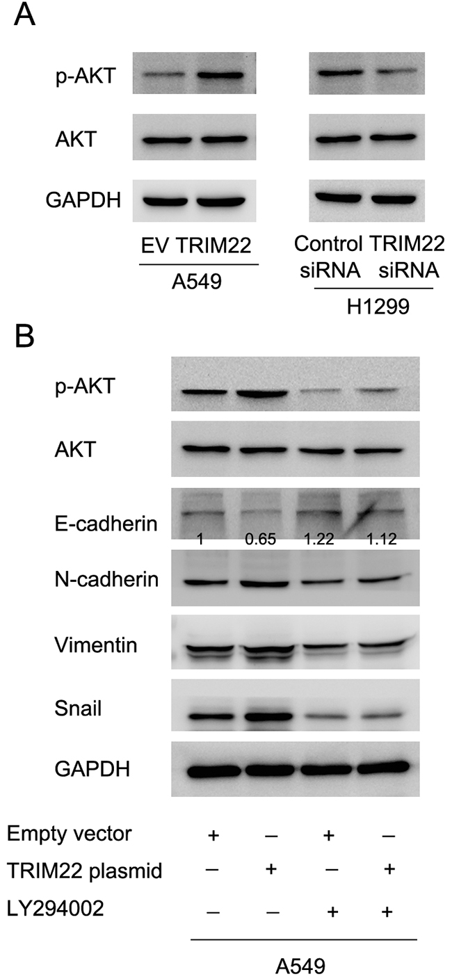 TRIM22 regulates epithelial-mesenchymal transition through activation of PI3K/AKT signaling.