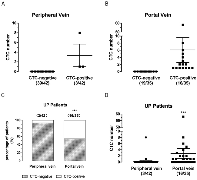 CTCs detection in first reflux vein blood is more sensitive than in peripheral blood in un-paired non-metastatic (UP) patients.