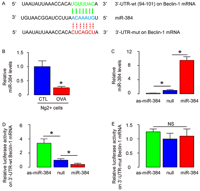 Enhanced autophagy in ASM cells from OVA-treated mice likely results from loss of suppression of protein translation of Beclin-1 by miR-384.