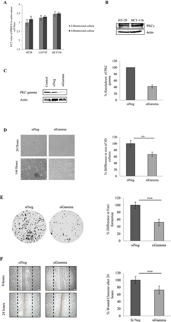 Effect of PKC gamma knockdown on colon cancer cells.