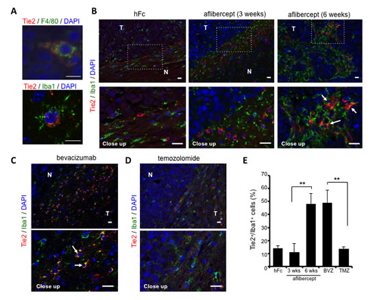 Over-representation of TEMs at the invasive front of tumors treated with anti-VEGF agents.