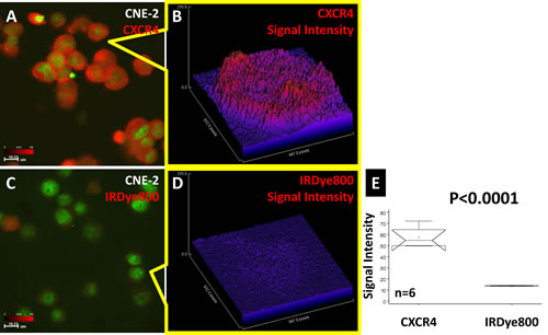 Fig 2: CXCR4 confocal imaging of human NPC CNE-2 cells.