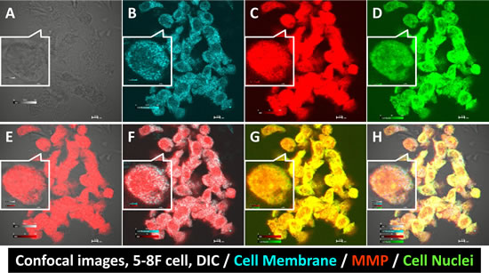 Fig 3: Confocal images of human NPC 5-8F cells binding to the MMP agent.