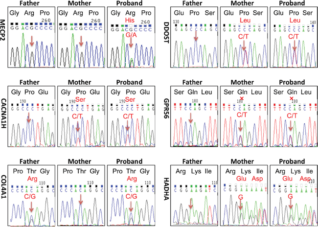 Sanger sequencing verified heterozygous variants identified by next generation sequencing technology.