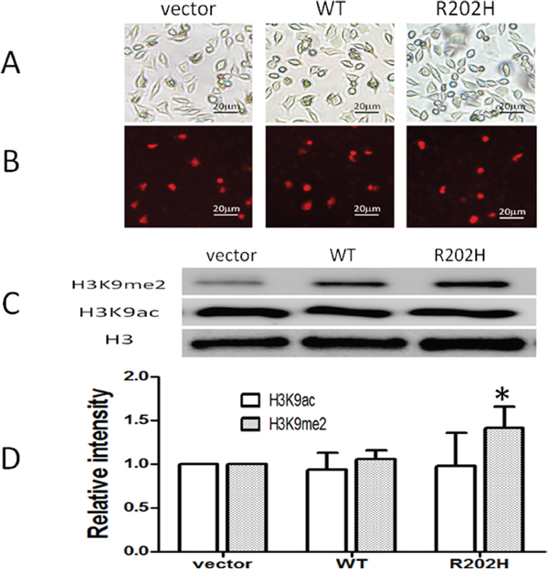 Missense mutation in the AT-hook 1 domain of MeCP2 increased level of H3K9me2 in SH-SY5Y cells.