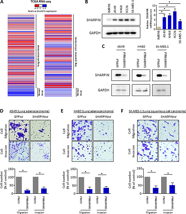 SHARPIN is a novel regulator of cell mobility in lung cancer cells.