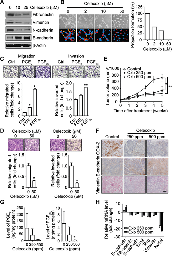 The COX-2 pathway regulates the EMT-like phenotype and invasiveness of IBC cells in vitro and tumor growth in vivo.