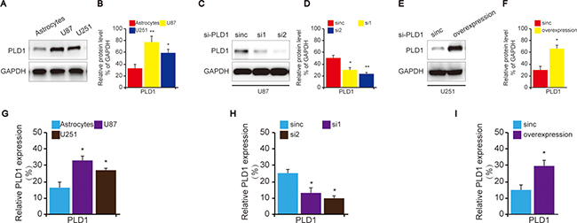The construction of PLD1 knockdown and overexpression glioma cells.