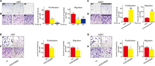 PLD1 overexpression facilitate proliferation and migration of glioma cells.