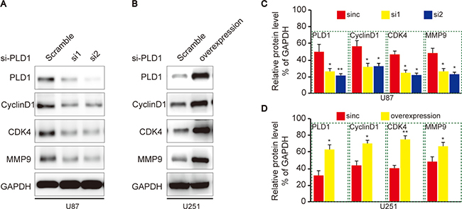 PLD1 regulates CyclinD1, CDK4 and MMP9 expression in glioma cells.