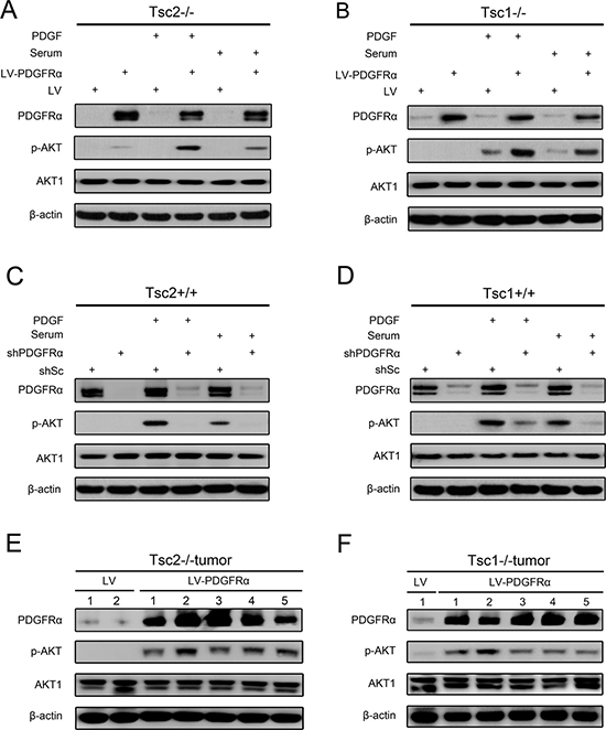 PDGFR&#x03B1; is essential for AKT activation.
