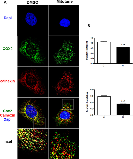 Mitotane reduces the integrity and extent of mitochondria-associated membranes in human adrenocortical carcinoma cells.