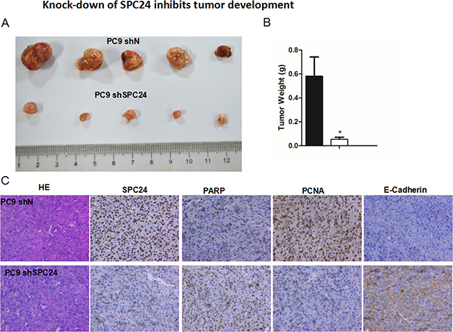 Knocking down SPC24 inhibits tumor growth in vivo.