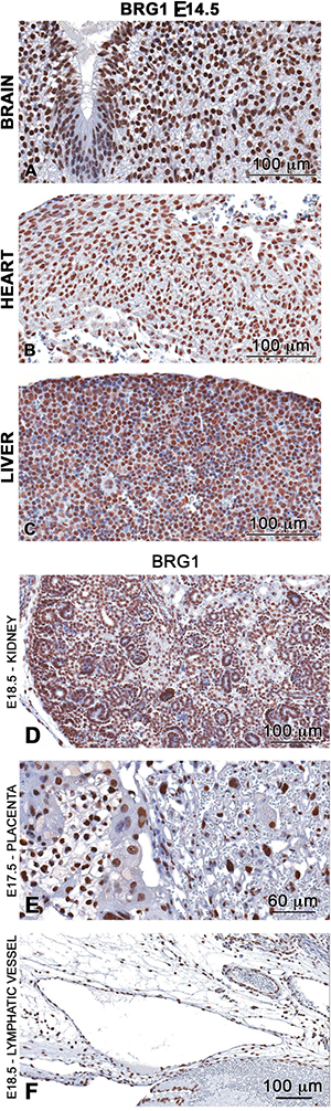 BRG1 is ubiquitously expressed in the developing embryo.