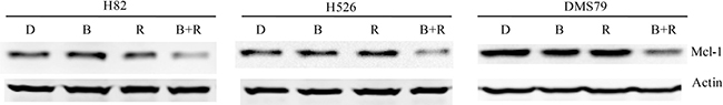 Remarkable inhibition of Mcl-1 protein expression in SCLC cells co-treated by RAD001 and BEZ235.