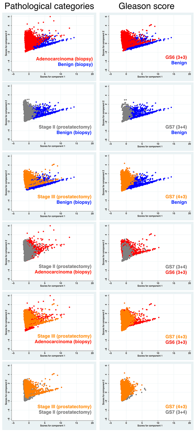 Pairwise comparative results of principle component analysis for Biomarkers I between the two types of disease characteristics (used in diagnosis); i.e. pathological categories including cancer stages versus GS.