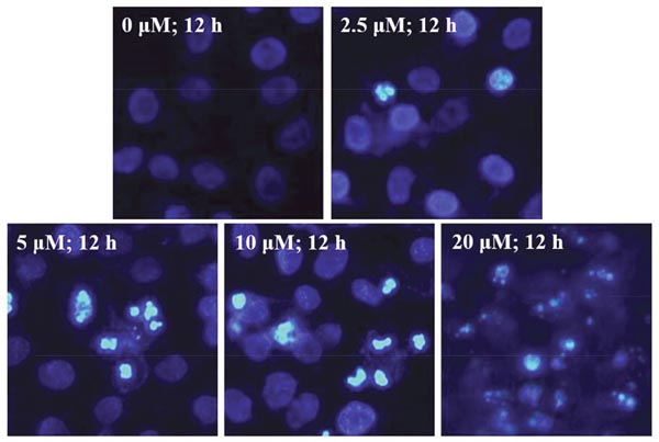 EMB-induced chromatin condensation in QSG7701 cells.