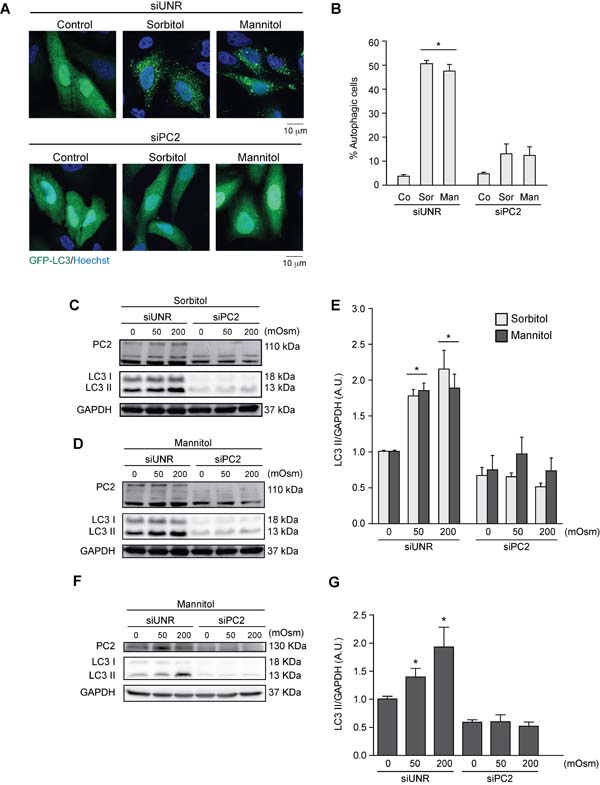 PC2 is required for hyperosmotic stress-induced autophagy.