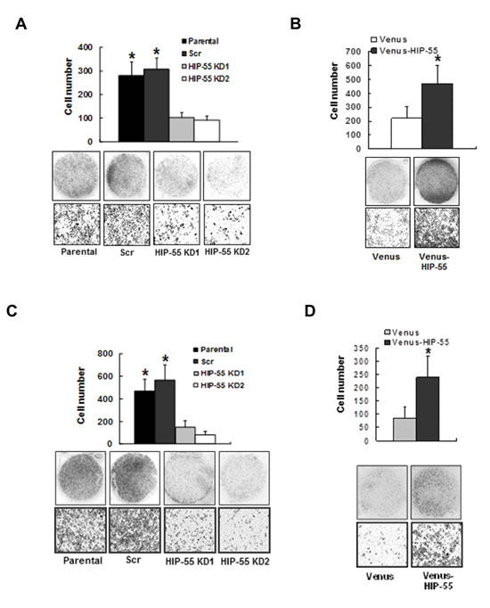 HIP-55 promotes cancer cell migration and invasion .