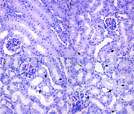 Histopathological changes in the kidney at 21 days of the experiment.