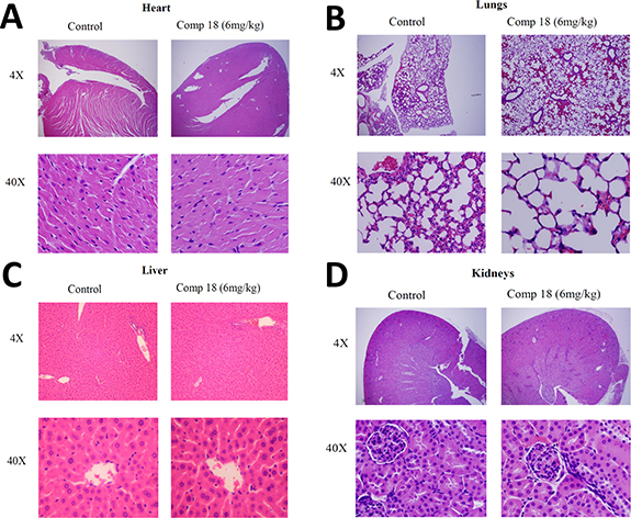 Histology studies compared organs from mice treated with compound 18 to organs from untreated control mice.