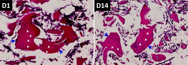HE staining and evaluation of co-culture of BMSCs with composite scaffold constructed using Si-CaP, autogenous fine particulate bone powder, and alginate.