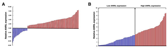 Figure 1:Relative ANRIL expression in human gastric cancer tissues.